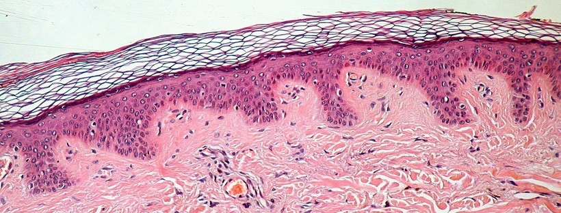 absorpcija etericnih olj